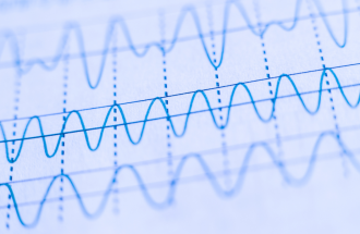 Signal Processing